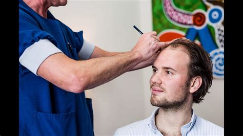 Veelgestelde Vragen Over Haartransplantatie